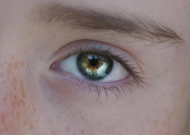 频繁眨眼、嘴角抽动是梅杰综合征？中医盛劲强教你早期识别与应对(图3)